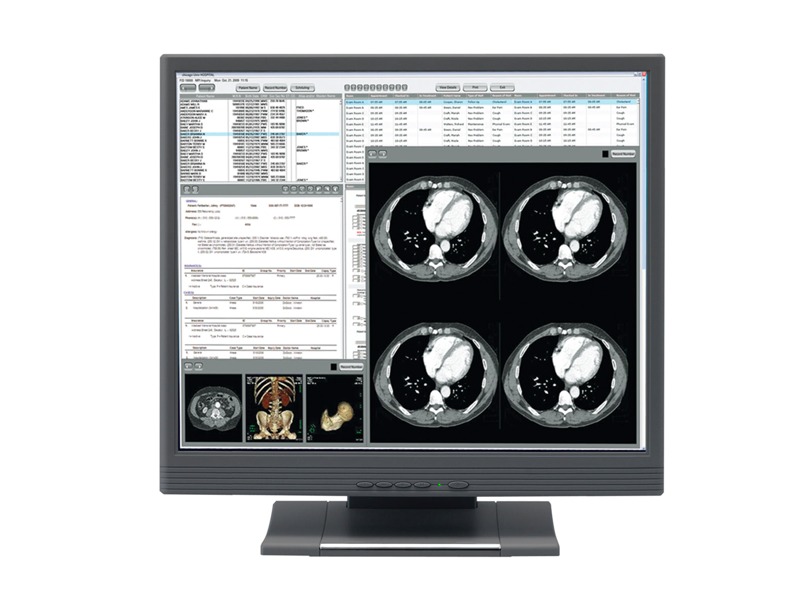 JVC CV932PJ 1MP 19" Touchscreen Color Clinical Review Display (CV932PJ)