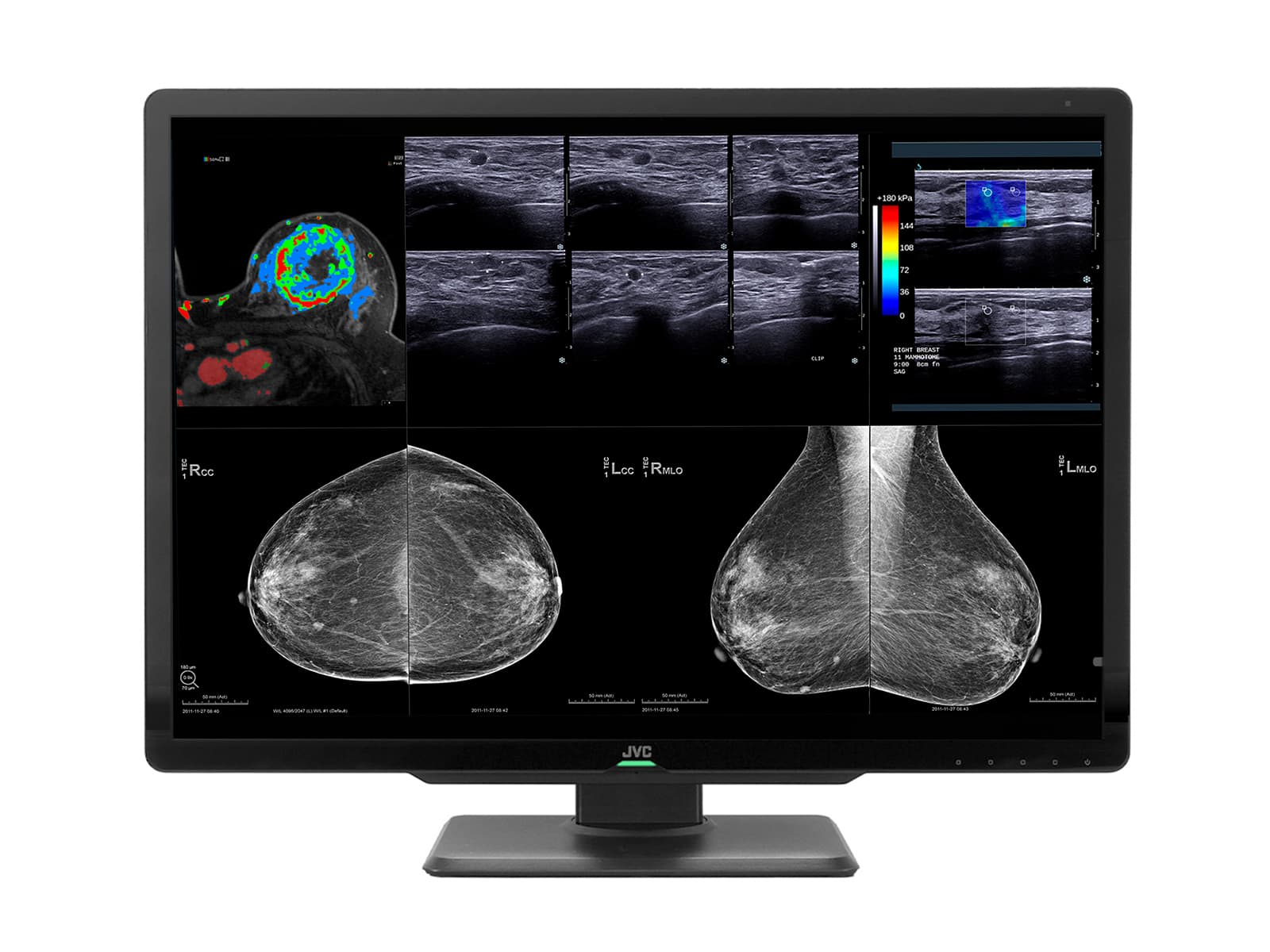 Estación completa de lectura de mamografías | Pantalla JVC Totoku | Estación de trabajo Lenovo CLS1200P520 Monitors.com