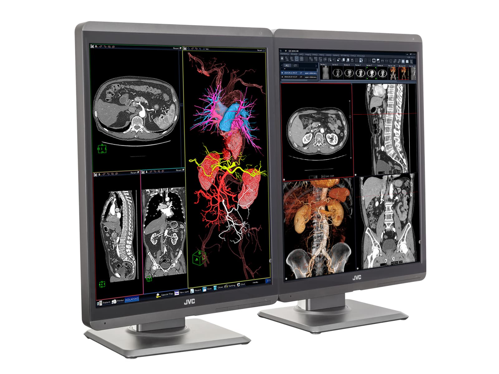 JVC Totoku CL-S300 3MP 21" Color LED General Radiology Diagnostic Display Monitors (CL-S300) 