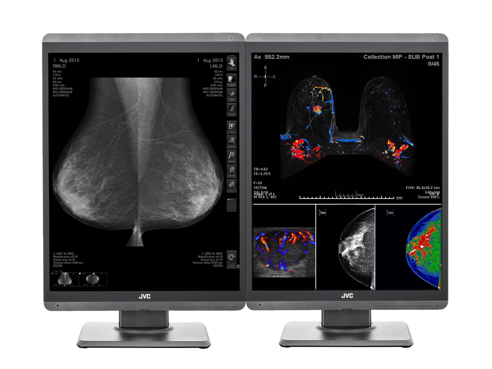 Complete Mammo Reading Station | JVC Totoku 3D-DBT Displays | HP Workstation (S500Z6N) Monitors.com 