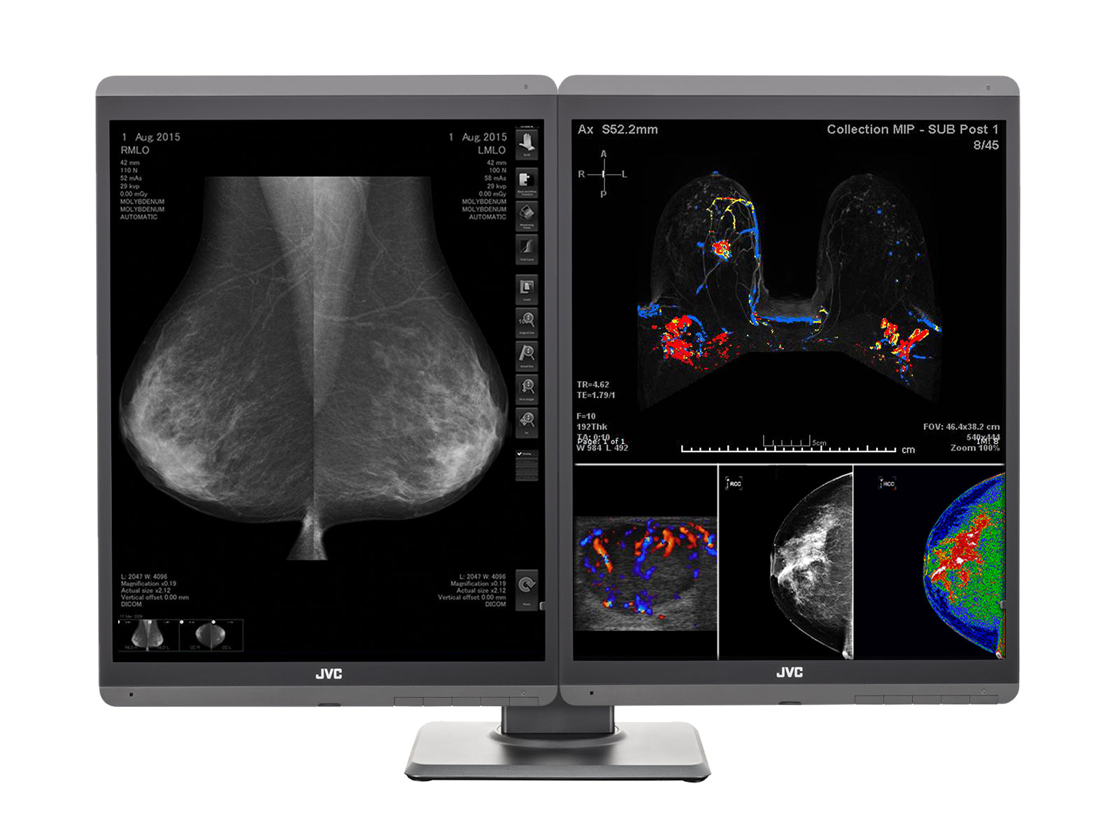 JVC Totoku CL-S500 5MP Color LED 3D-DBT Breast Imaging