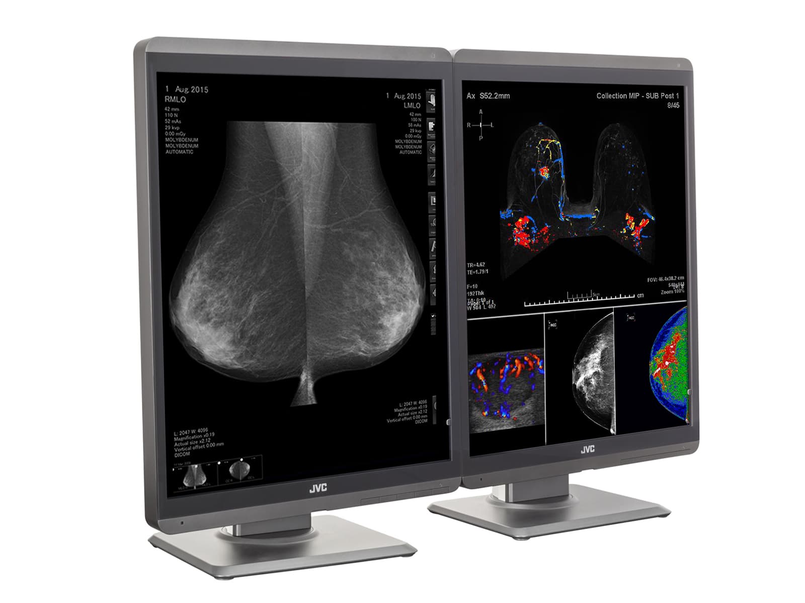 JVC ＬＭ-173B JVC Totoku CL-S500 5MP Color LED 3D-DBT Breast Imaging