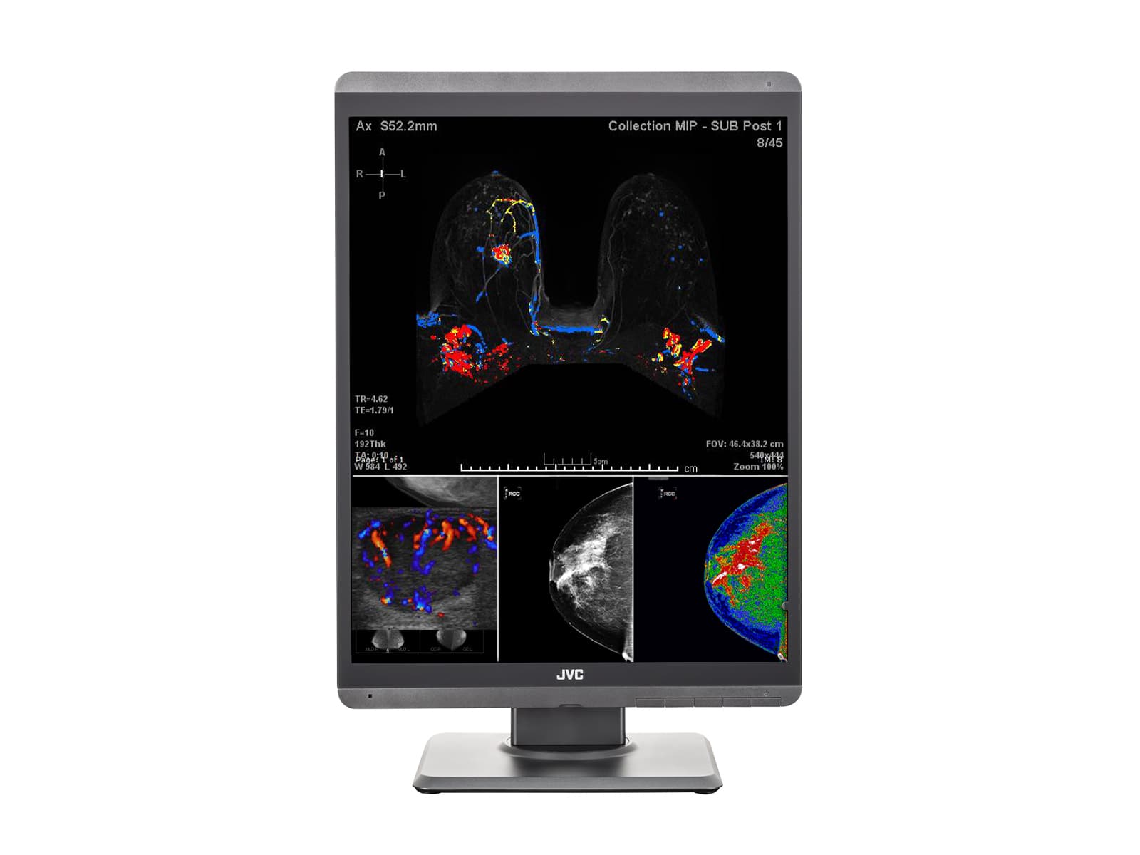 JVC Totoku CL-S500 5MP 21" Color LED Mammo 3D-DBT Breast Imaging Display (CL-S500)