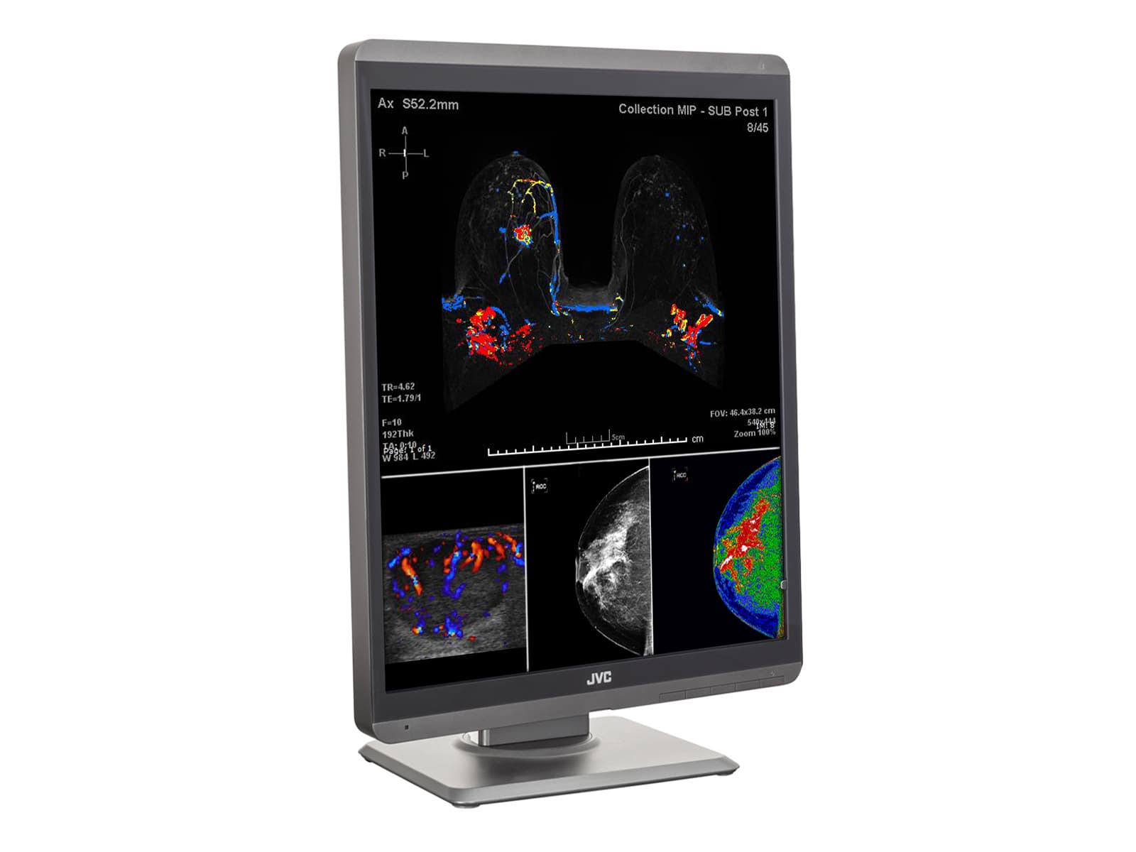 JVC Totoku CL-S500 5MP 21" Color LED Mammo 3D-DBT Breast Imaging Display (CL-S500)