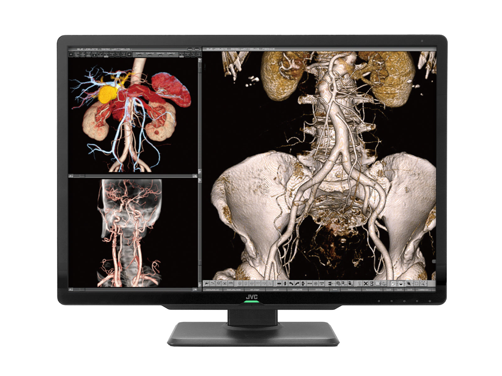 JVC Totoku CL-S600 6MP 30" Farb-LED-PACS-Display für allgemeine Radiologie (CL-S600) Monitore.com