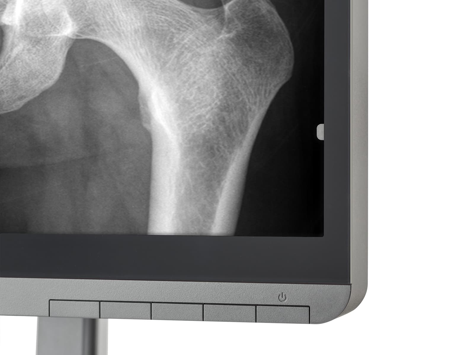 JVC Totoku MS-S300 3MP 21" LED Grayscale General Radiology Diagnostic Display Monitor (MS-S300)