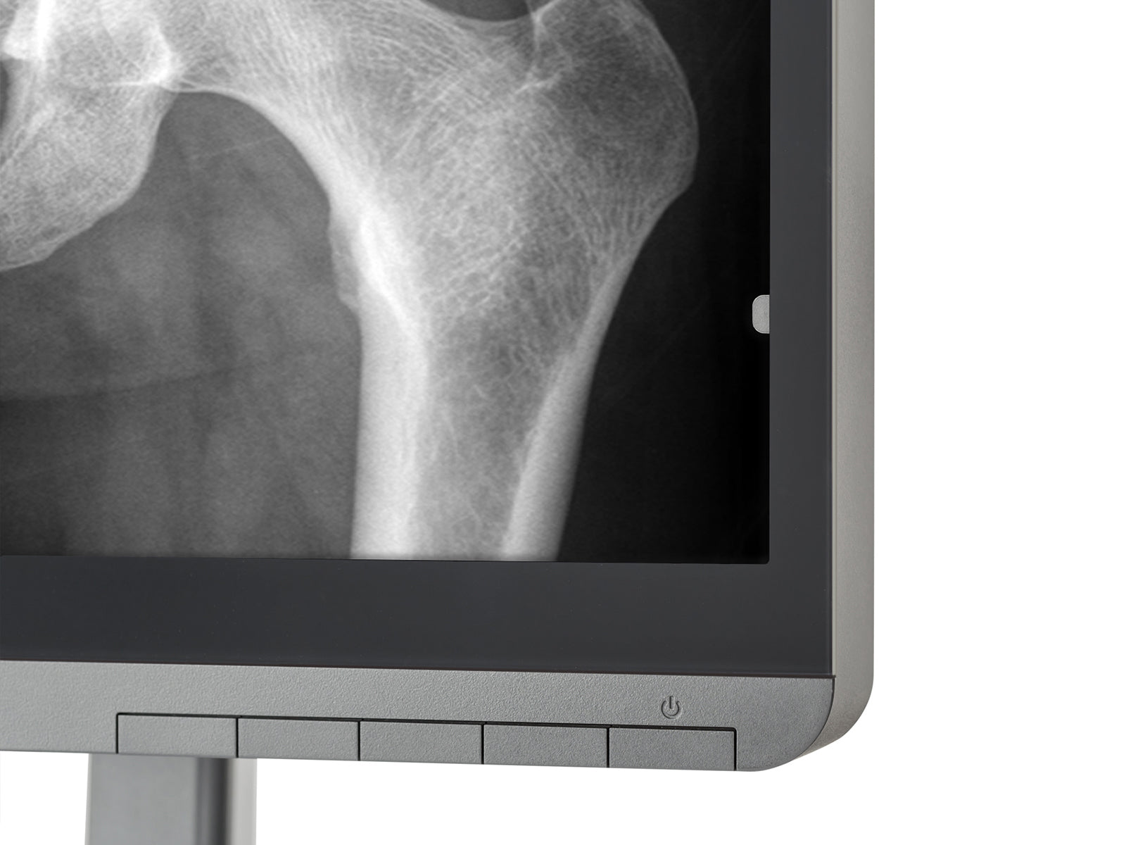 JVC Totoku CL-R211 2MP 21" Color Clinical Review Display Monitor (CL-R211)