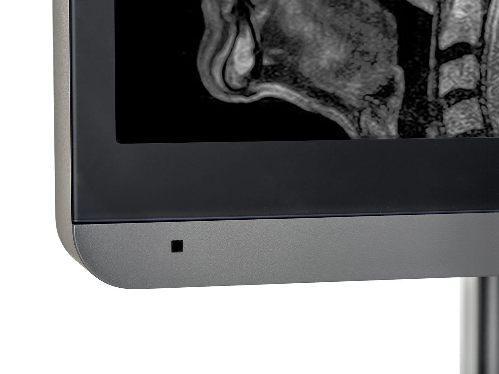 JVC Totoku CL-R211 2MP 21" Color Clinical Review Display Monitor (CL-R211)