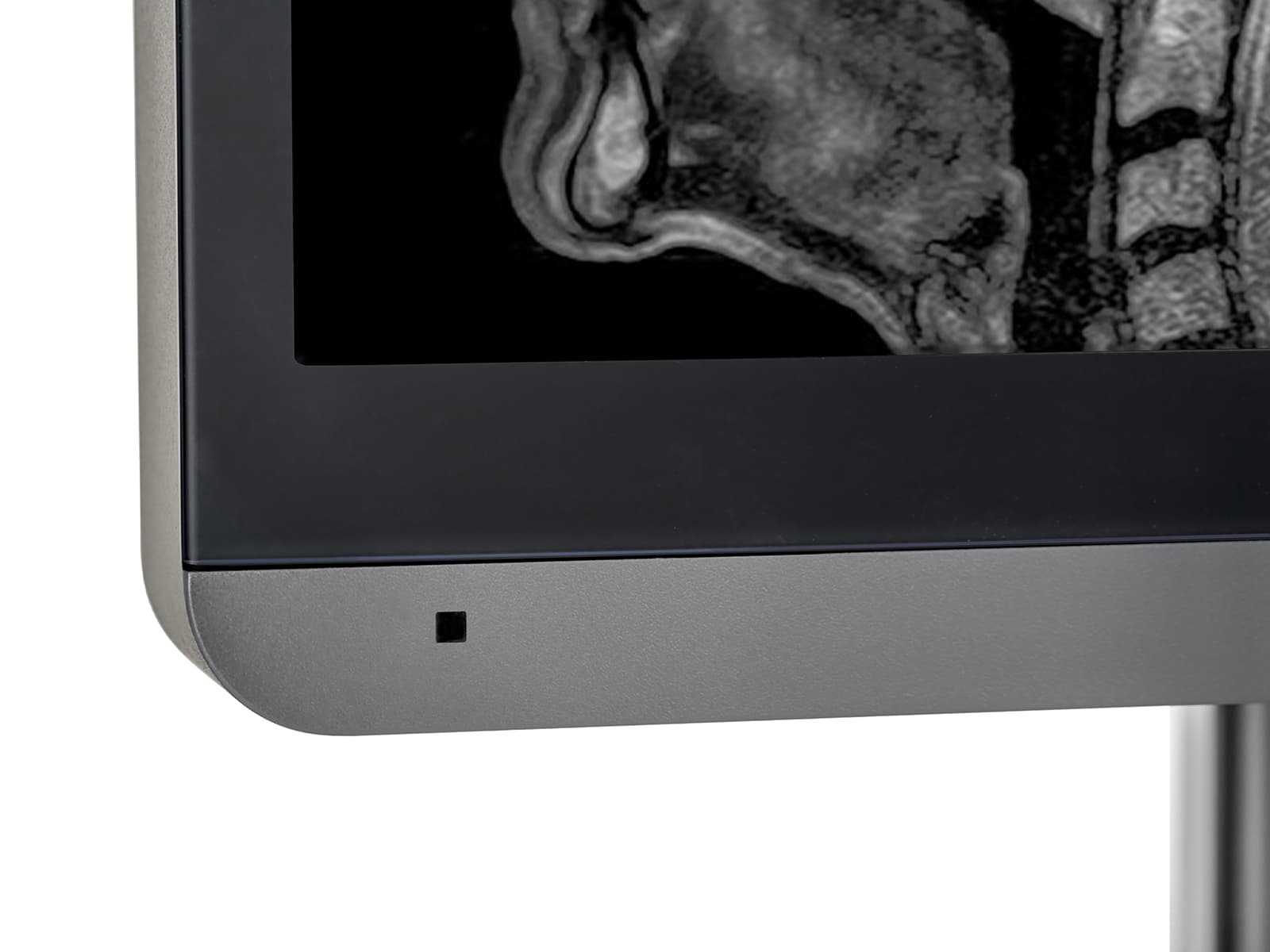 JVC Totoku MS-S500 5MP 21" Mammo 3D-DBT Grayscale LED Breast Imaging Display (MS-S500)