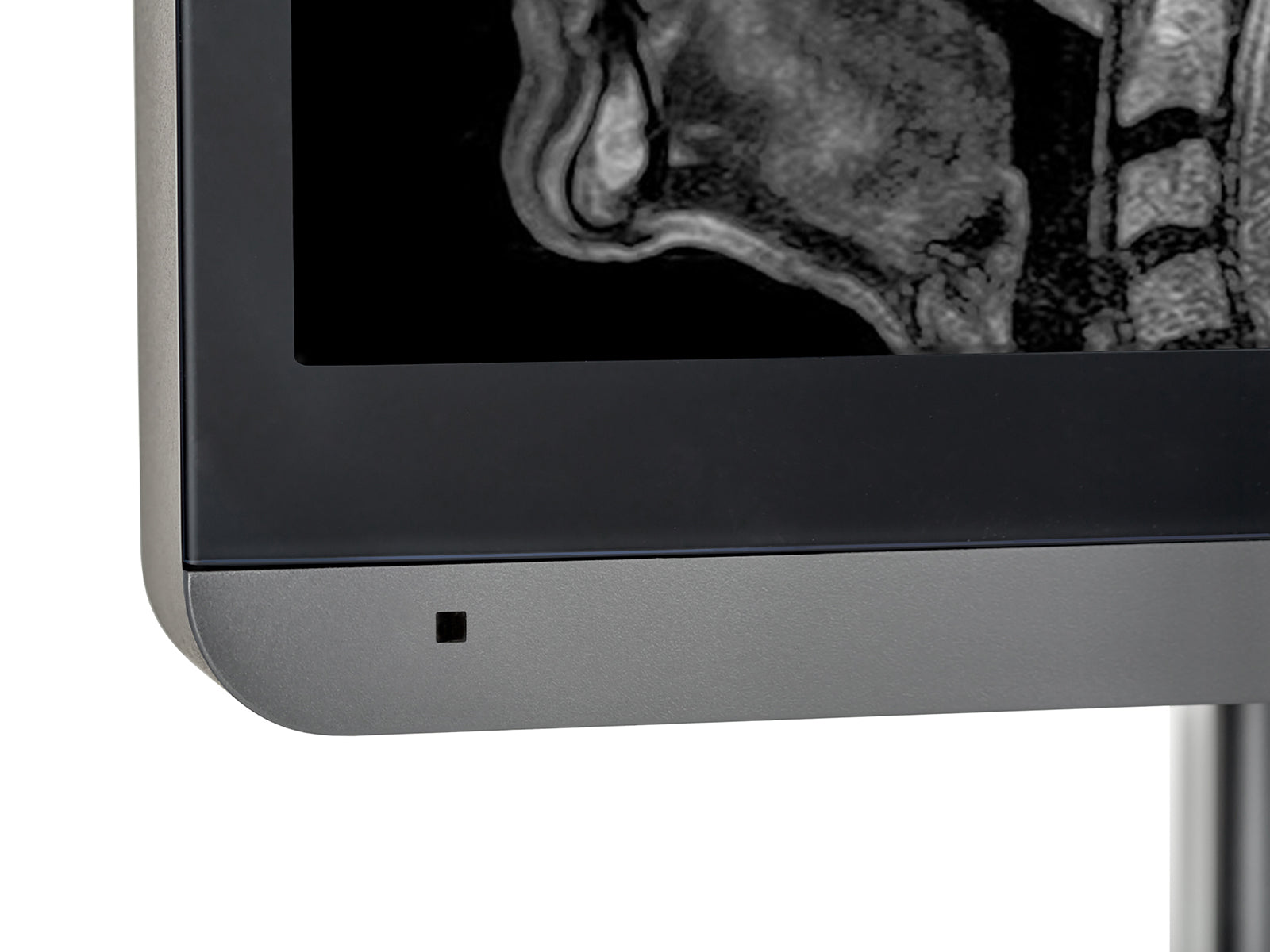 JVC Totoku MS-S200 2MP 21" Grayscale Diagnostic Radiology Display Monitor (MS-S200) Monitors.com 
