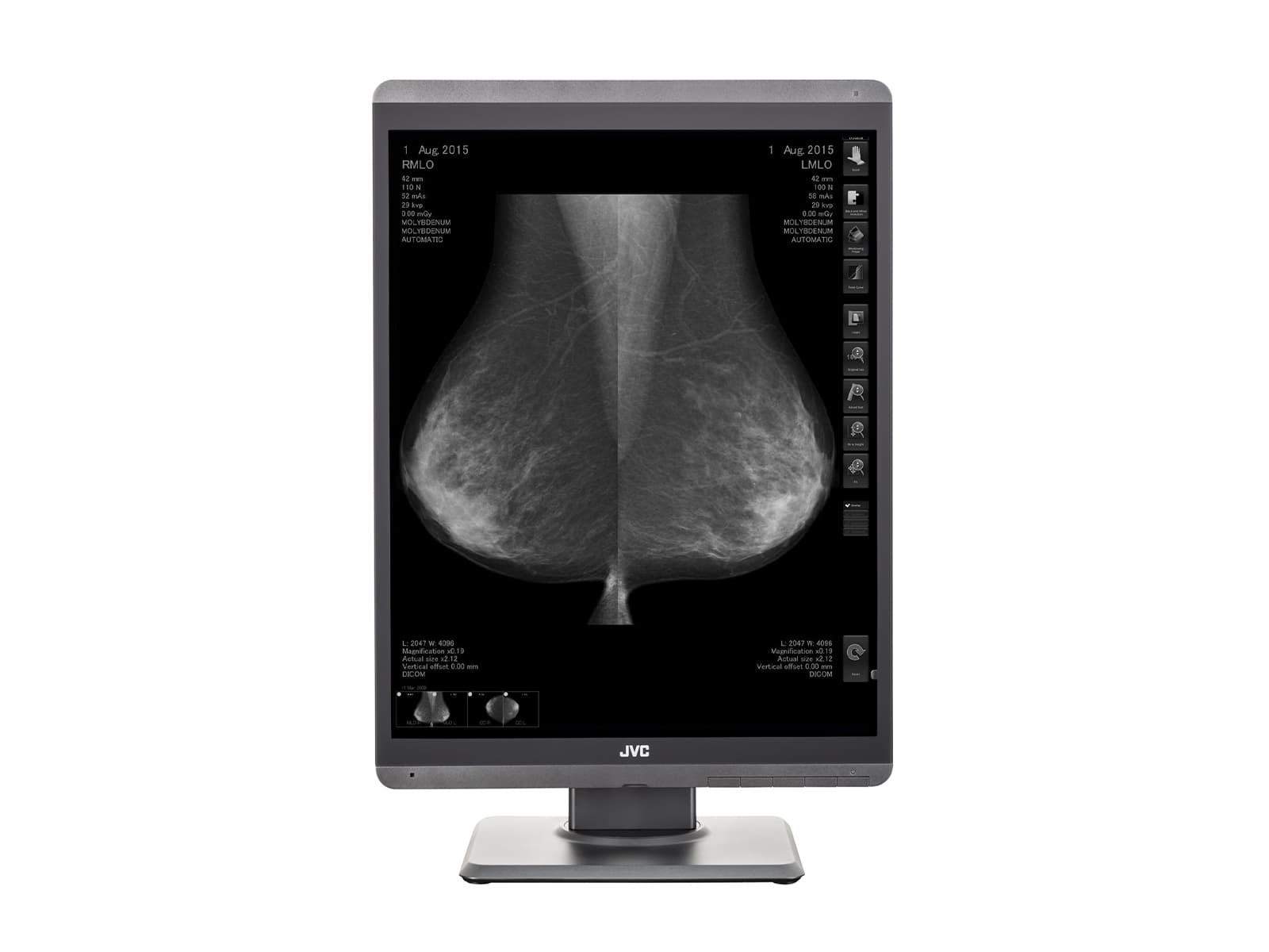 JVC Totoku MS-S500 5MP 21" Mammo 3D-DBT Grayscale LED Breast Imaging Display (MS-S500)