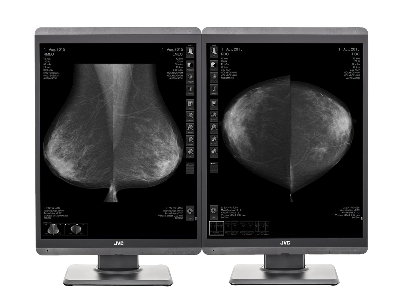 Écran d'imagerie mammaire LED en niveaux de gris Mammo 500D-DBT 5MP 21" JVC Totoku MS-S3 (MS-S500) Monitors.com