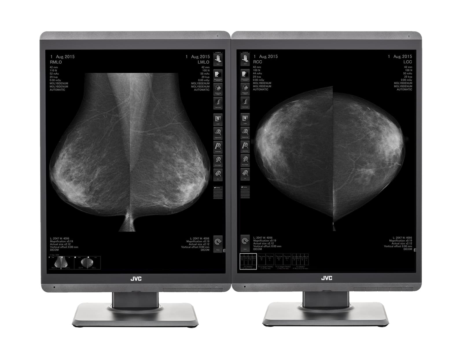 JVC Totoku MS-S500 5MP 21" Mammo 3D-DBT Grayscale LED Breast Imaging Display (MS-S500) Monitors.com 