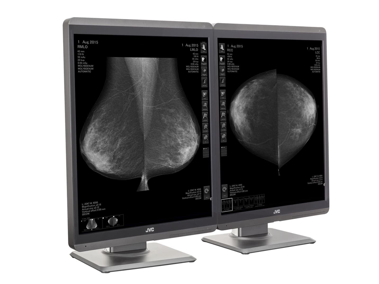 JVC Totoku MS-S500 5MP 21" Mammo 3D-DBT Grayscale LED Breast Imaging Display (MS-S500)