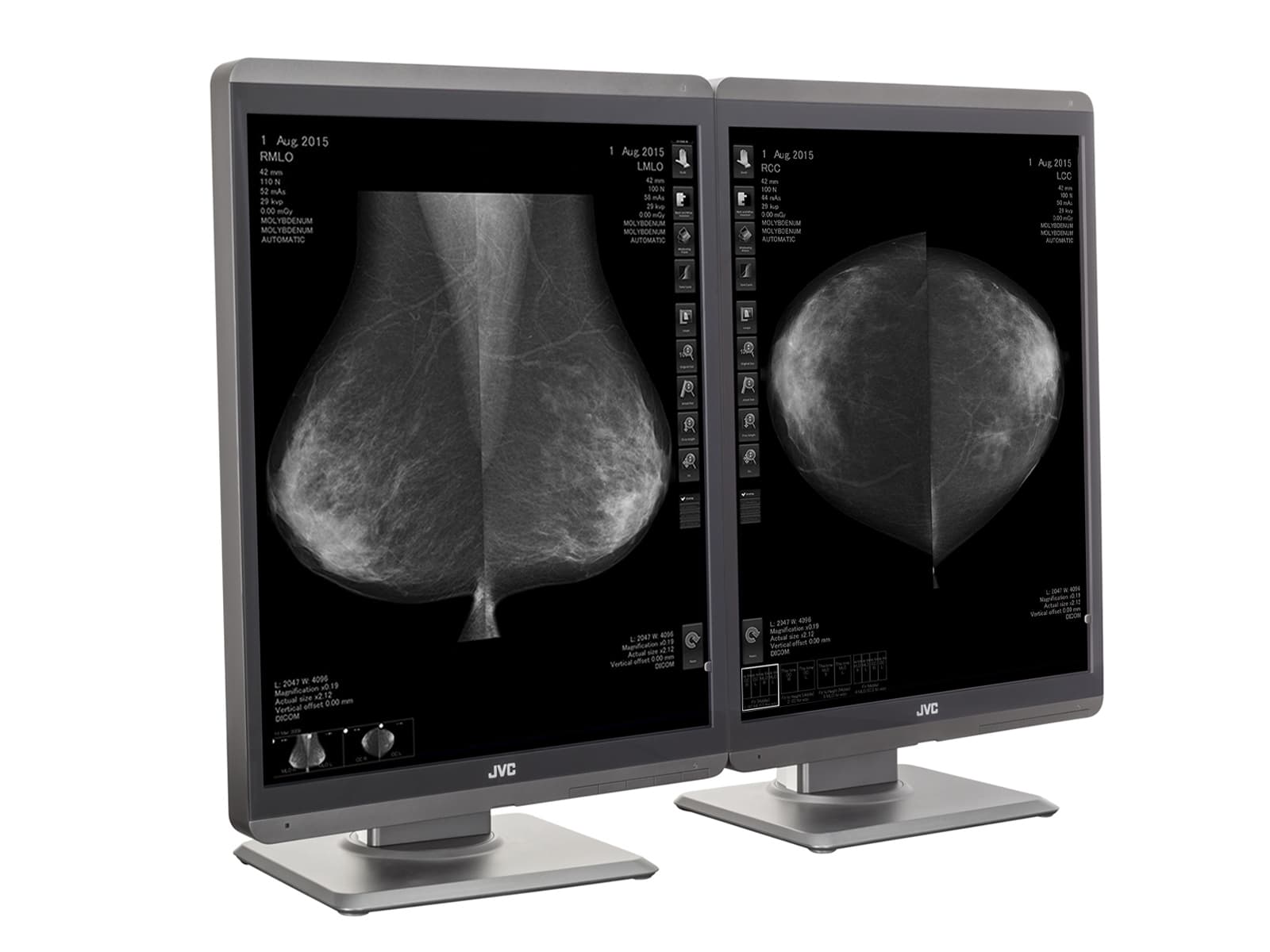 JVC Totoku MS-S500 5MP 21" Mammo 3D-DBT Grayscale LED Breast Imaging Display (MS-S500) Monitors.com 