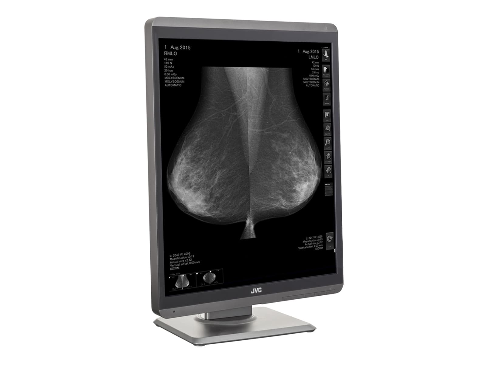 JVC Totoku MS-S500 5MP 21" Mammo 3D-DBT Grayscale LED Breast Imaging Display (MS-S500) Monitors.com 