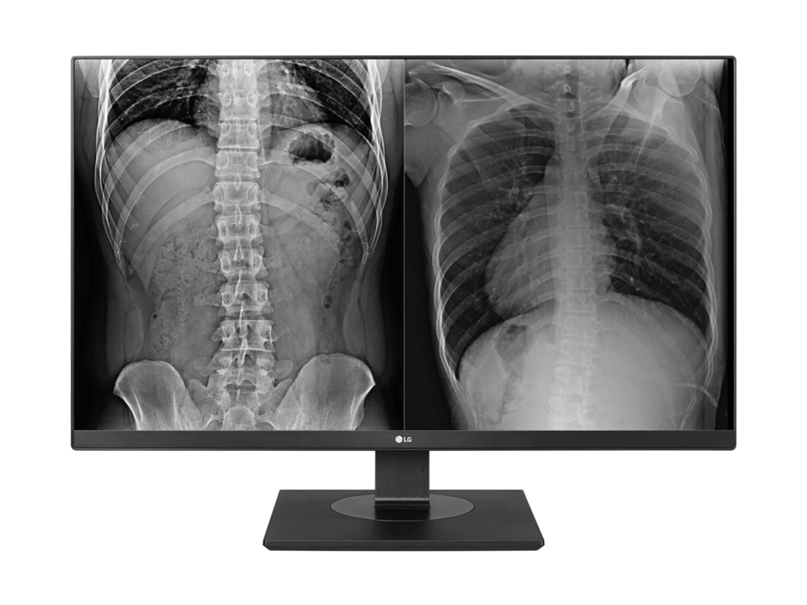 Moniteur d'affichage couleur d'examen clinique LG 27HJ713C 8MP 27" (27HJ713C-B) Monitors.com