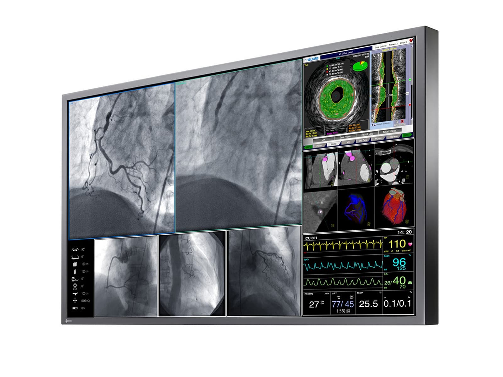 Eizo RadiForce LX600W 60.1" 8MP 4K Surgical Medical Display Monitor (LX600W)