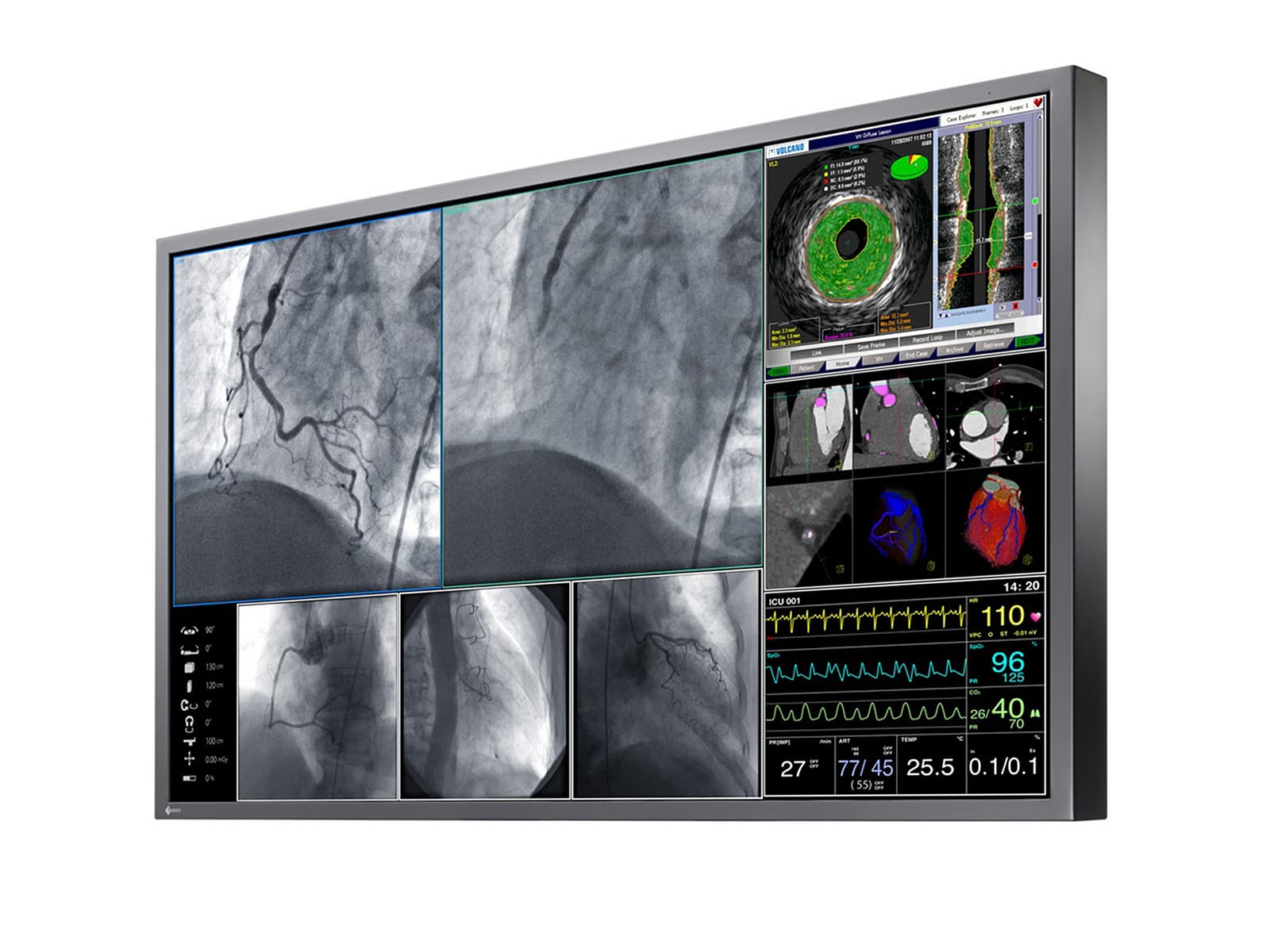 Eizo RadiForce LX600W 60" 8MP 4K Color Surgical Medical Display Monitor (LX600W) Monitors.com 