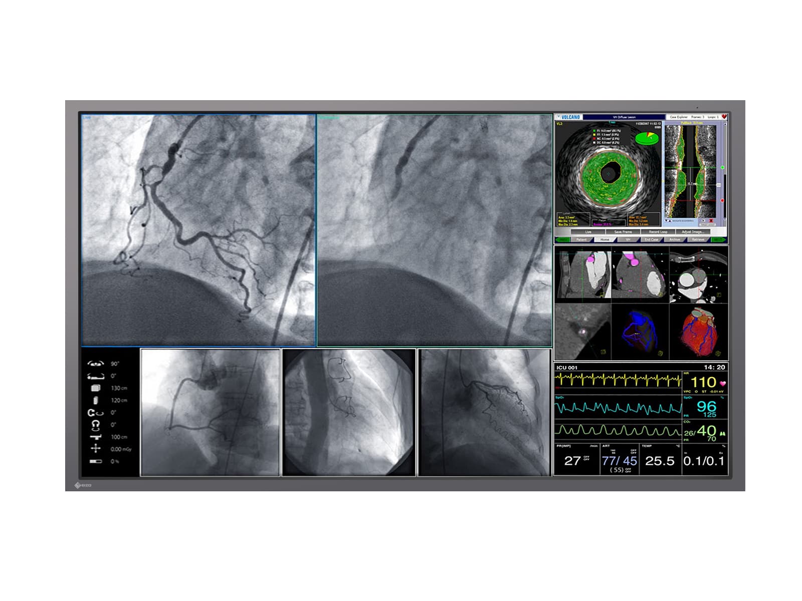 Eizo RadiForce LX600W Monitor de pantalla médico quirúrgico en color 60K, 8" y 4 MP (LX600W) Monitors.com