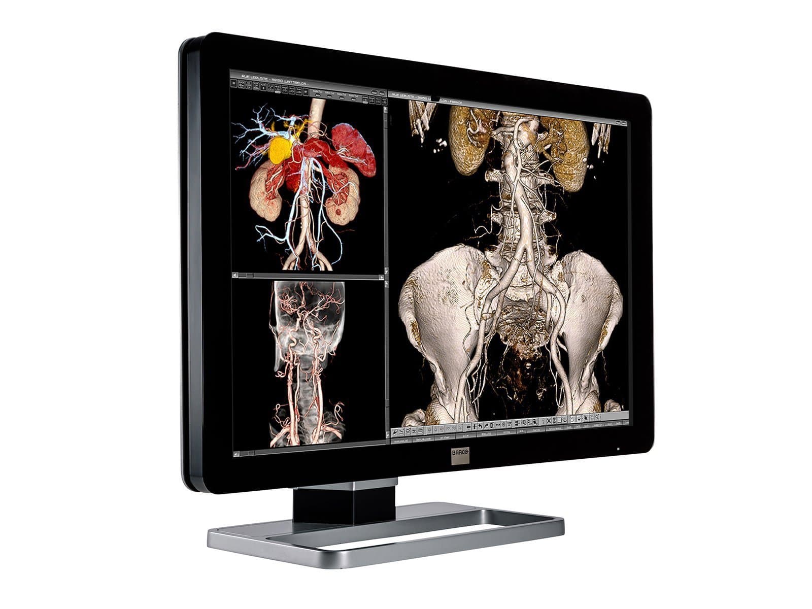 Complete PACS General Radiology Station | Barco 6MP Color LED Display | Dell Workstation | Dictation Mic | Worklist Monitor (6230Z6R) Monitors.com 