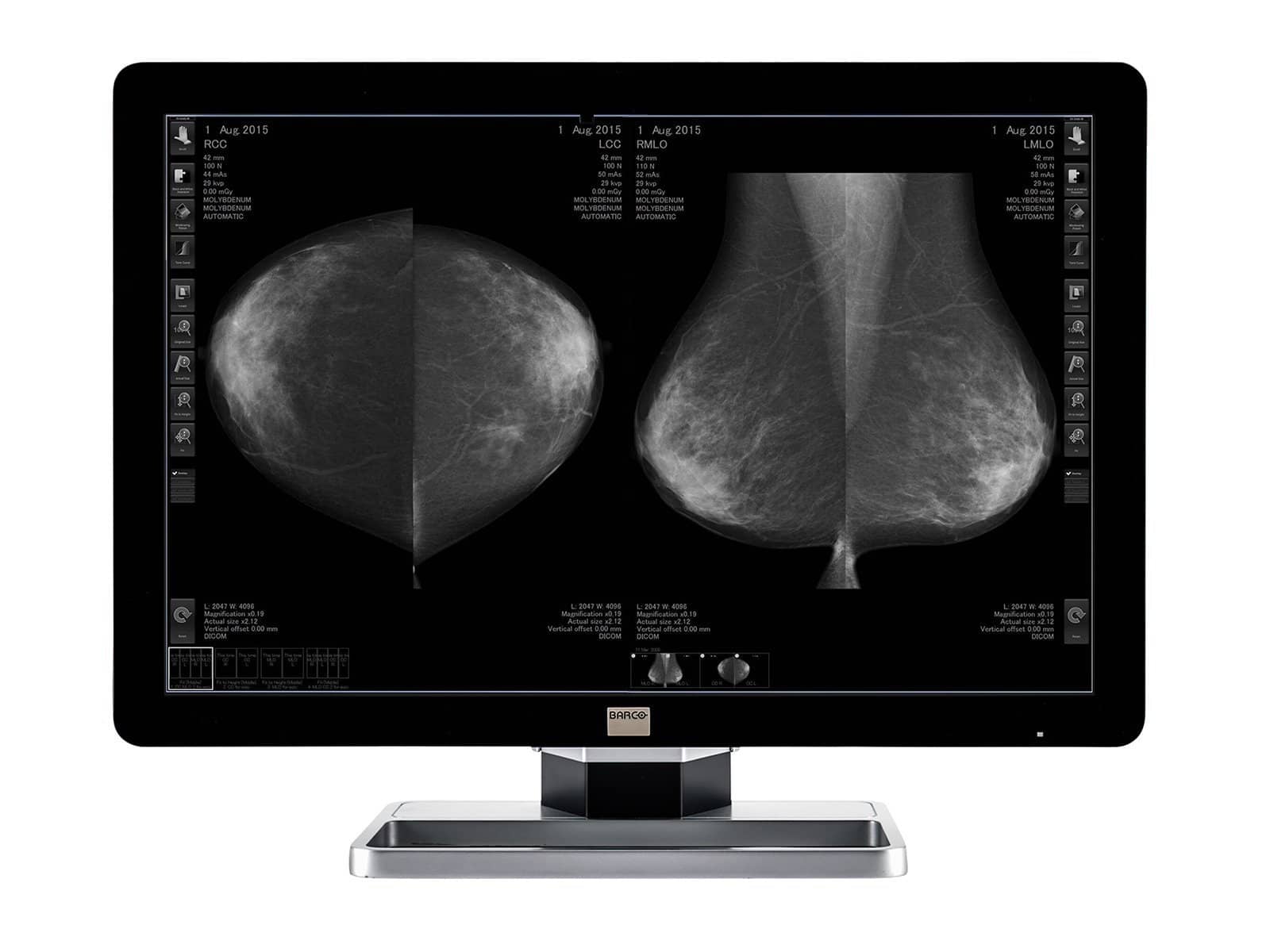 Barco Coronis Fusion MDCG-10130 10MP 30" Grayscale Mammo 3D-DBT Breast Imaging Display Monitors.com 