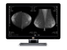 Barco Coronis Fusion MDCG-10130 10MP 30 "Graustufen Mammo 3D-DBT Brustbildgebungsdisplay