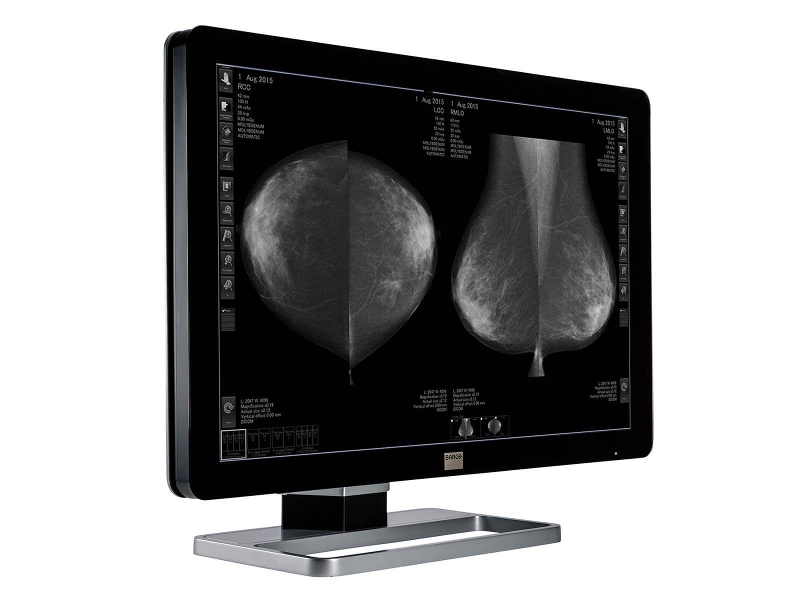 Barco Coronis Fusion MDCG-10130 10MP 30" Grayscale Mammo 3D-DBT Breast Imaging Display