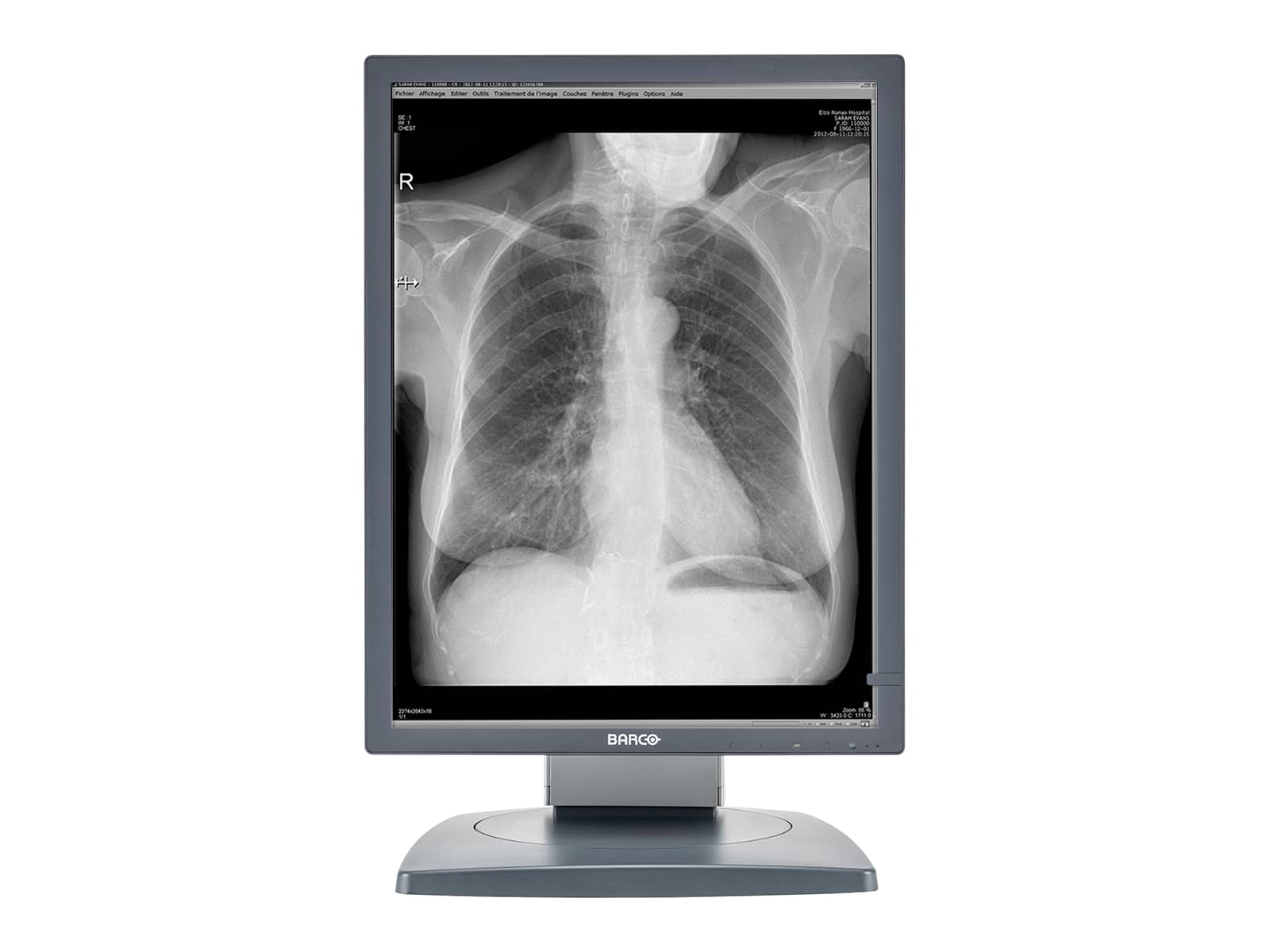 Barco Coronis MDCG-3120 3MP 21" Grayscale General Radiology Diagnostic Display (K9601662) Monitors.com 