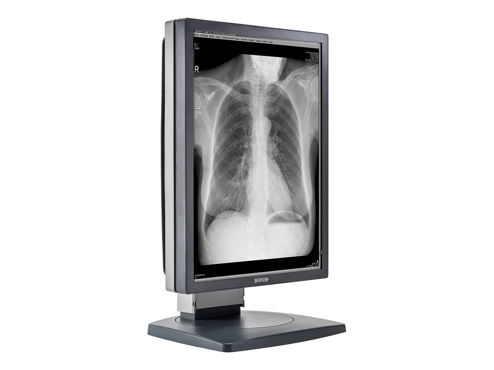 Barco Coronis MDCG-3120 3MP 20" Grayscale General Radiology Diagnostic Display Monitors.com 