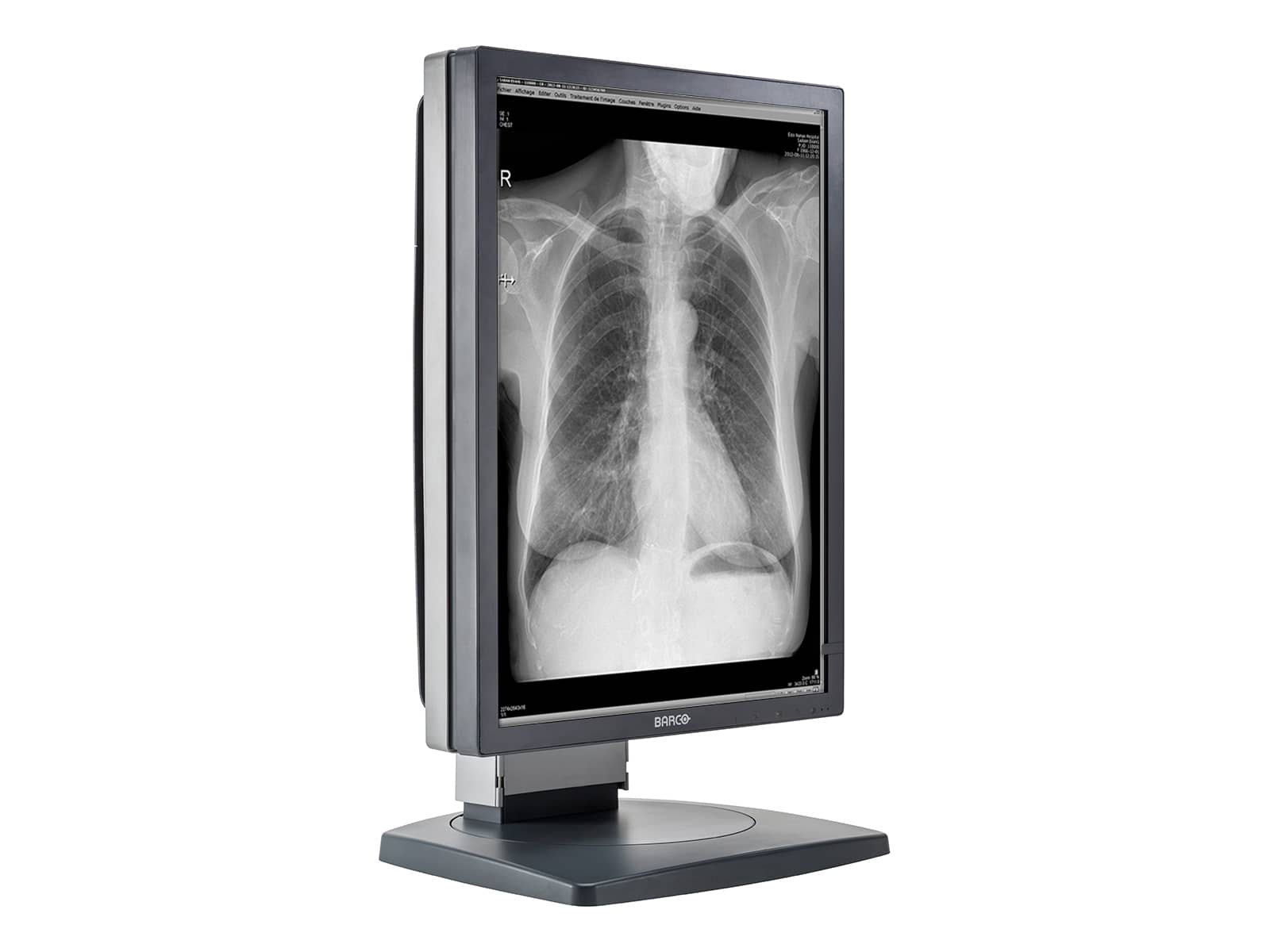 Barco Coronis MDCG-3120 3MP 21" Graustufen-Diagnosedisplay für allgemeine Radiologie (K9601662) Monitors.com