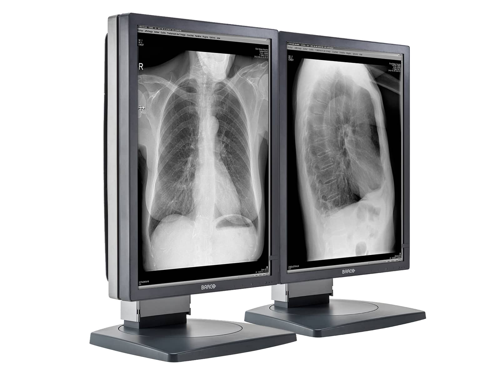 Barco Coronis MDCG-2121 2MP 21" Grayscale Diagnostic Radiology PACS Monitor