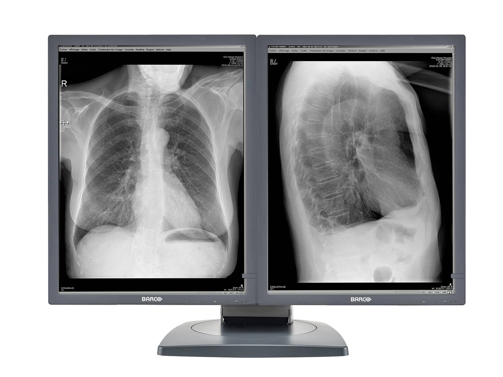 Barco Coronis MDCG-2121 2MP 21" Grayscale Diagnostic Radiology PACS Monitor Monitors.com 