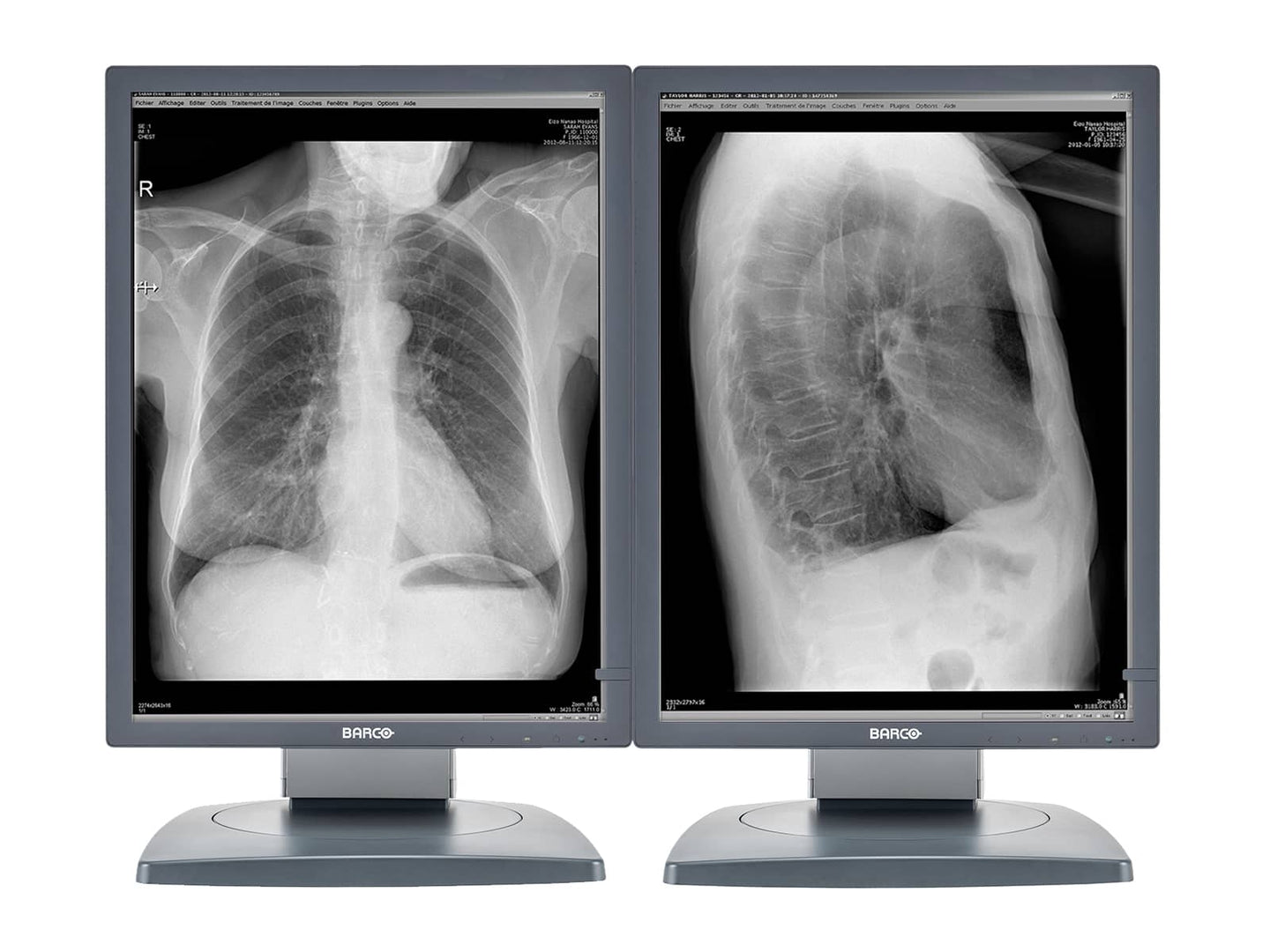 Barco Coronis MDCG-3120 3MP Diagnostic Display Review