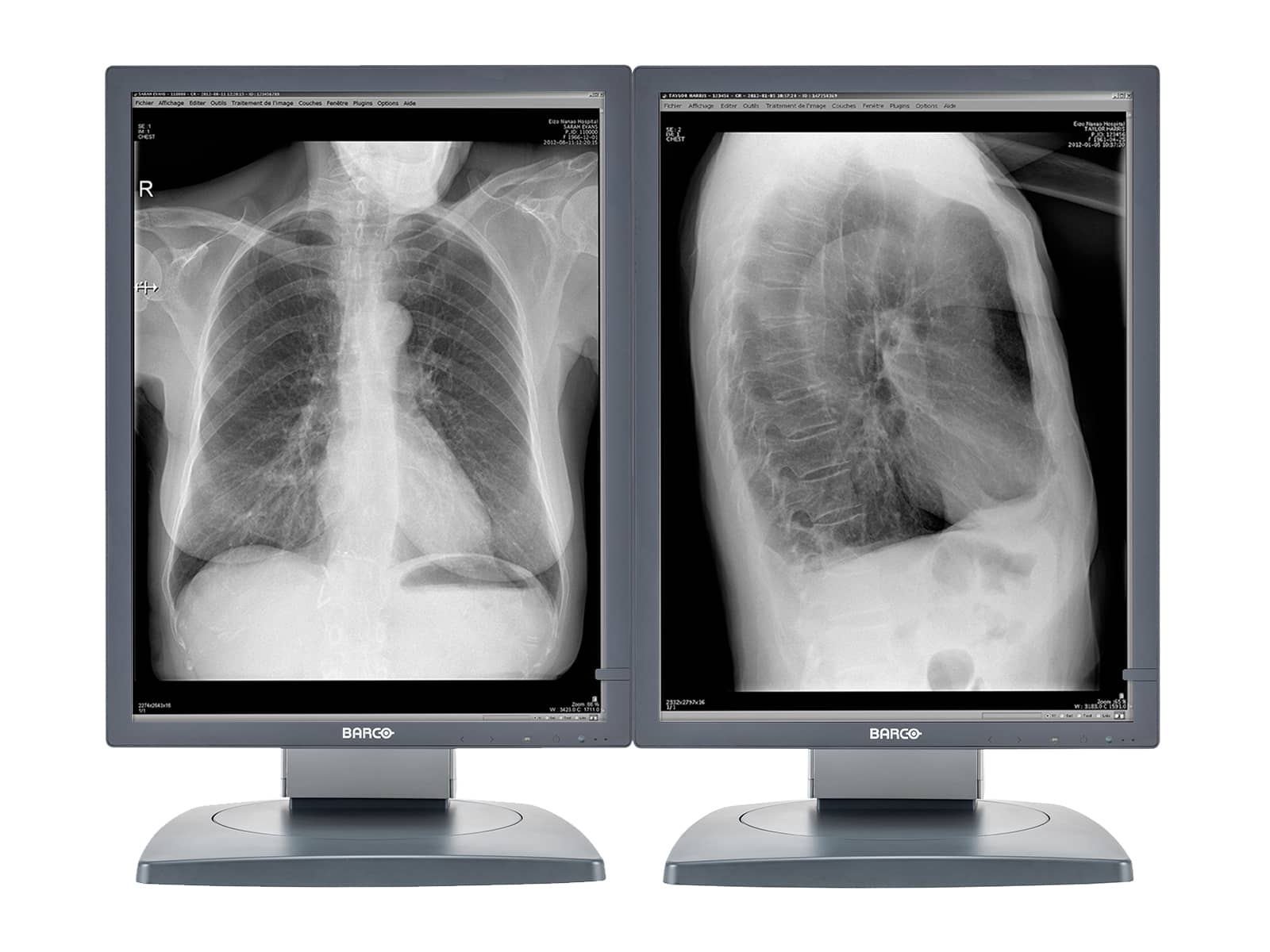 Barco Coronis MDCG-3120 21" Graustufen-Diagnosedisplay für allgemeine Radiologie (K9601662) Monitors.com