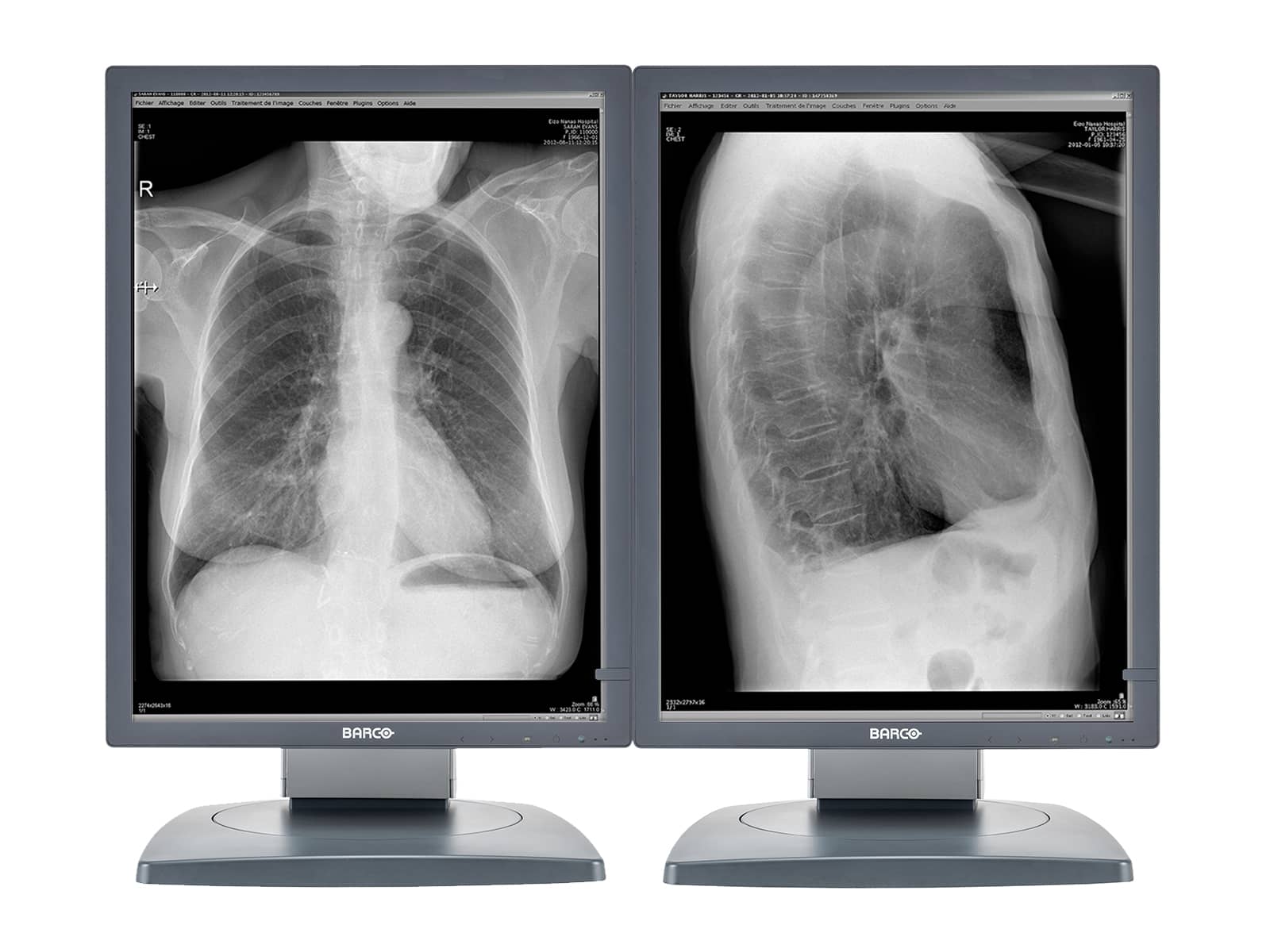 Barco Moniteur PACS de radiologie diagnostique en niveaux de gris Coronis MDCG-2121 2MP 21" (K9601659) Monitors.com