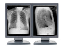 Barco Coronis MDCG-2121 2MP 21" Graustufen-PACS-Monitor für die diagnostische Radiologie