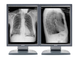Barco Coronis MDCG-3120 3MP 20.8