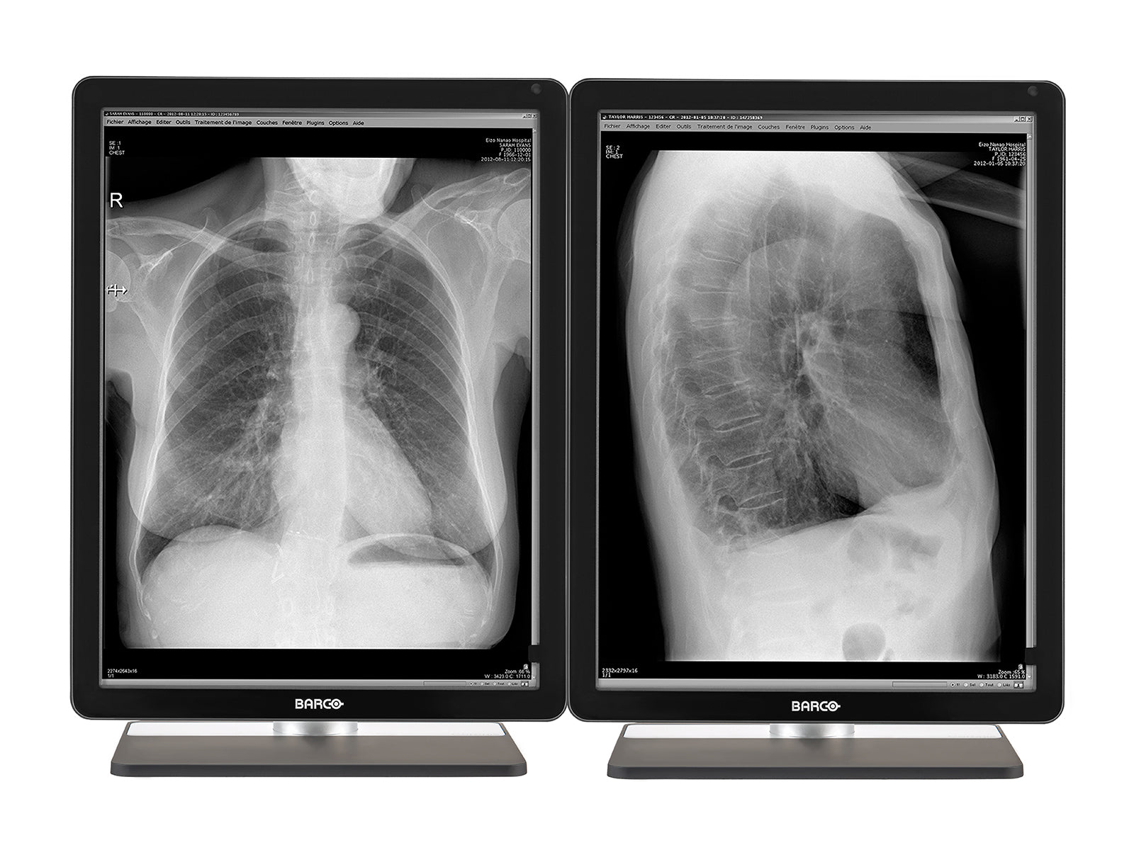 Complete PACS General Radiology Station | Barco 3MP Grayscale LED Displays | Lenovo Workstation