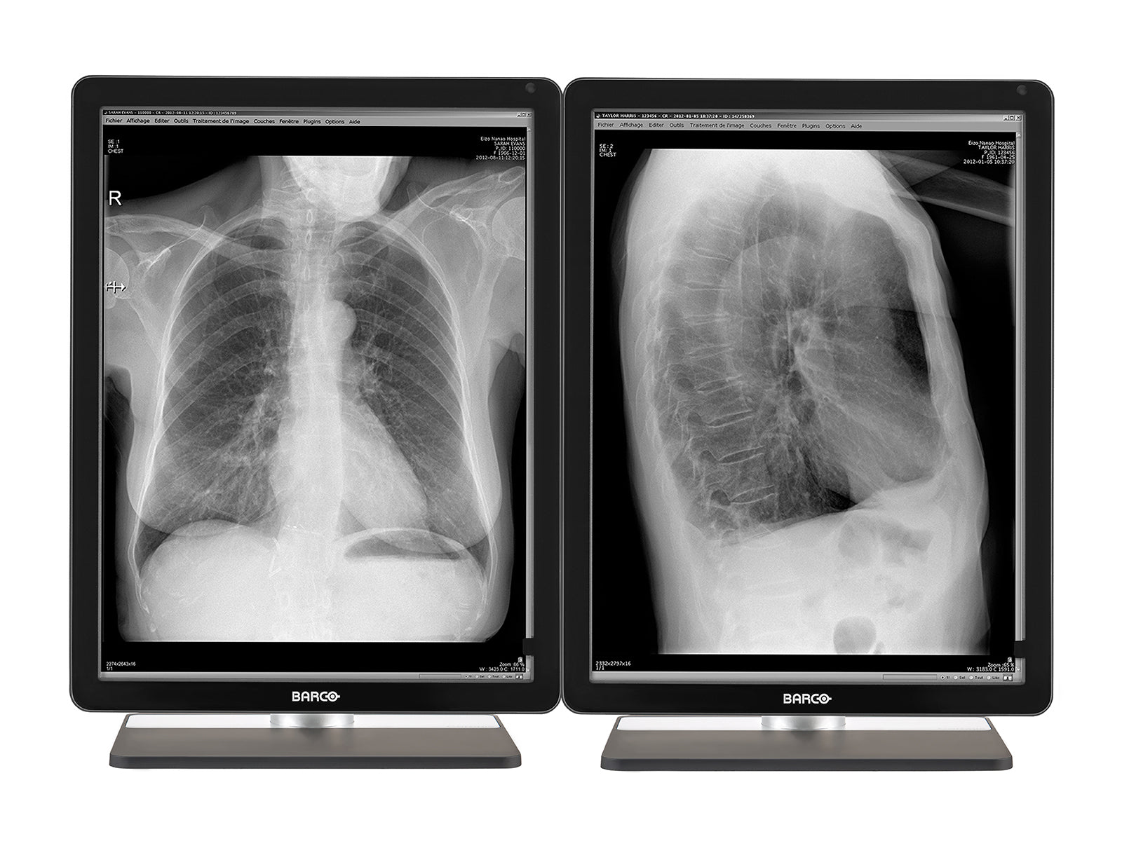 محطة الأشعة العامة PACS كاملة | Barco 3MP شاشات LED ذات تدرج الرمادي | Lenovo محطة العمل | ميكروفون الإملاء | شاشة قائمة العمل (3221Z4R)