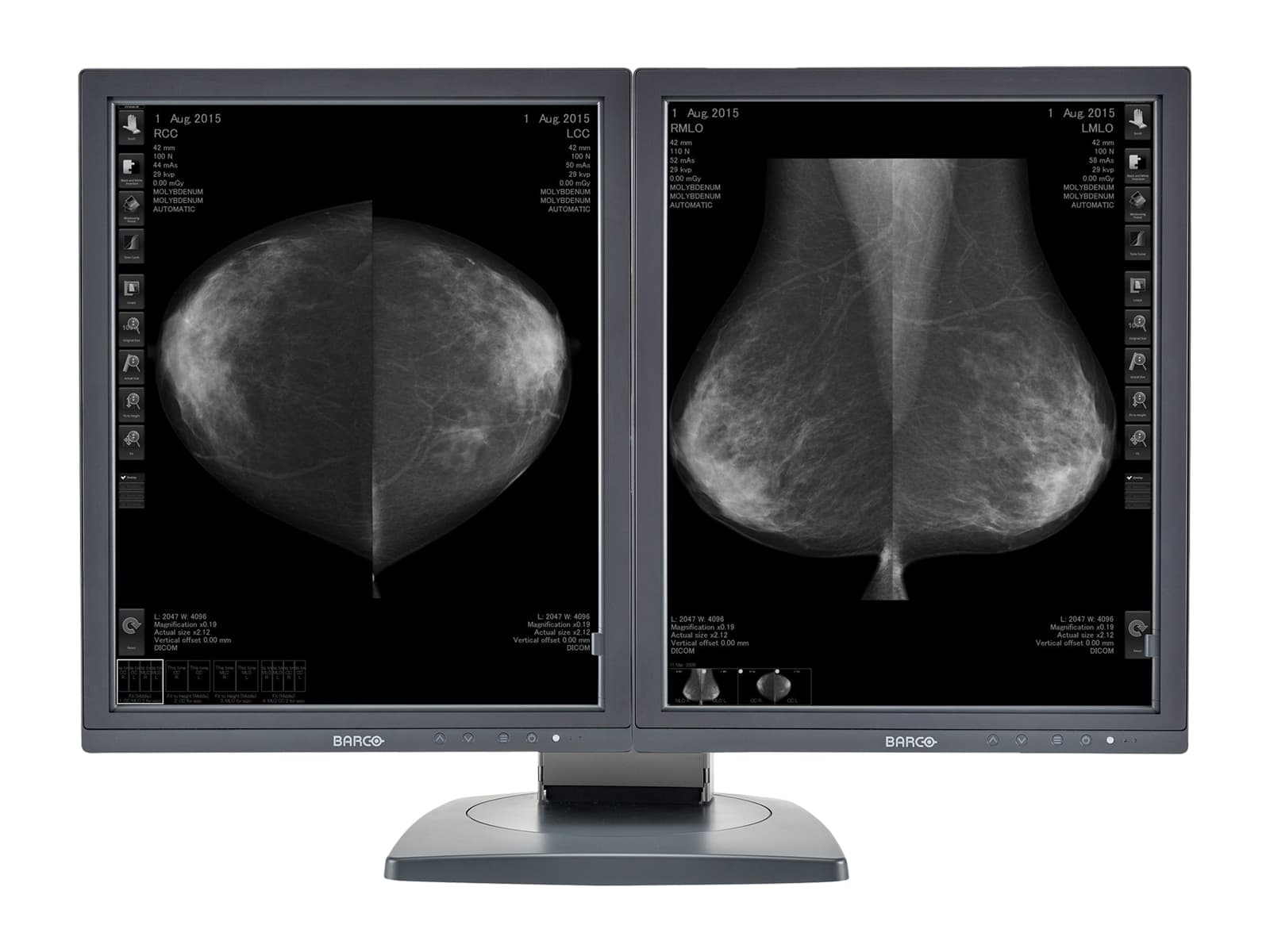 Complete Mammography Reading Station | Barco 5MP Grayscale 3D-DBT Displays | Dell Workstation | Dictation Mic | Worklist Monitor (5121Z6R) Monitors.com 