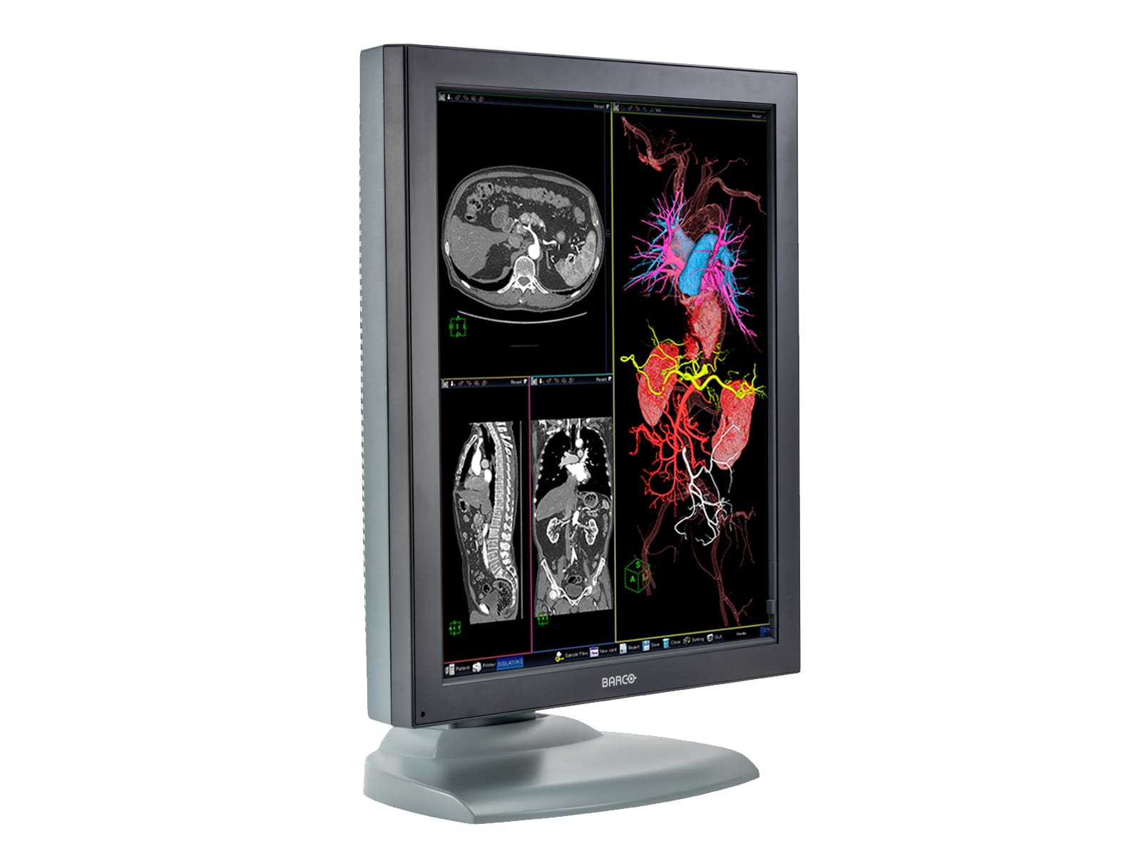 Barco Nio MDNC-3121 Monitor de radiología de diagnóstico médico en color de 3MP y 21" (K9603023) Monitors.com