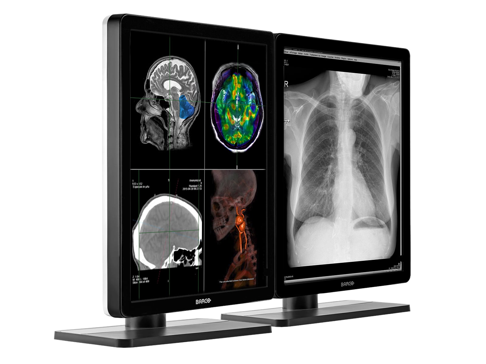 Barco Nio MDNC-2221 2MP 21" Kleuren LED Diagnostische Radiologie Display Monitor