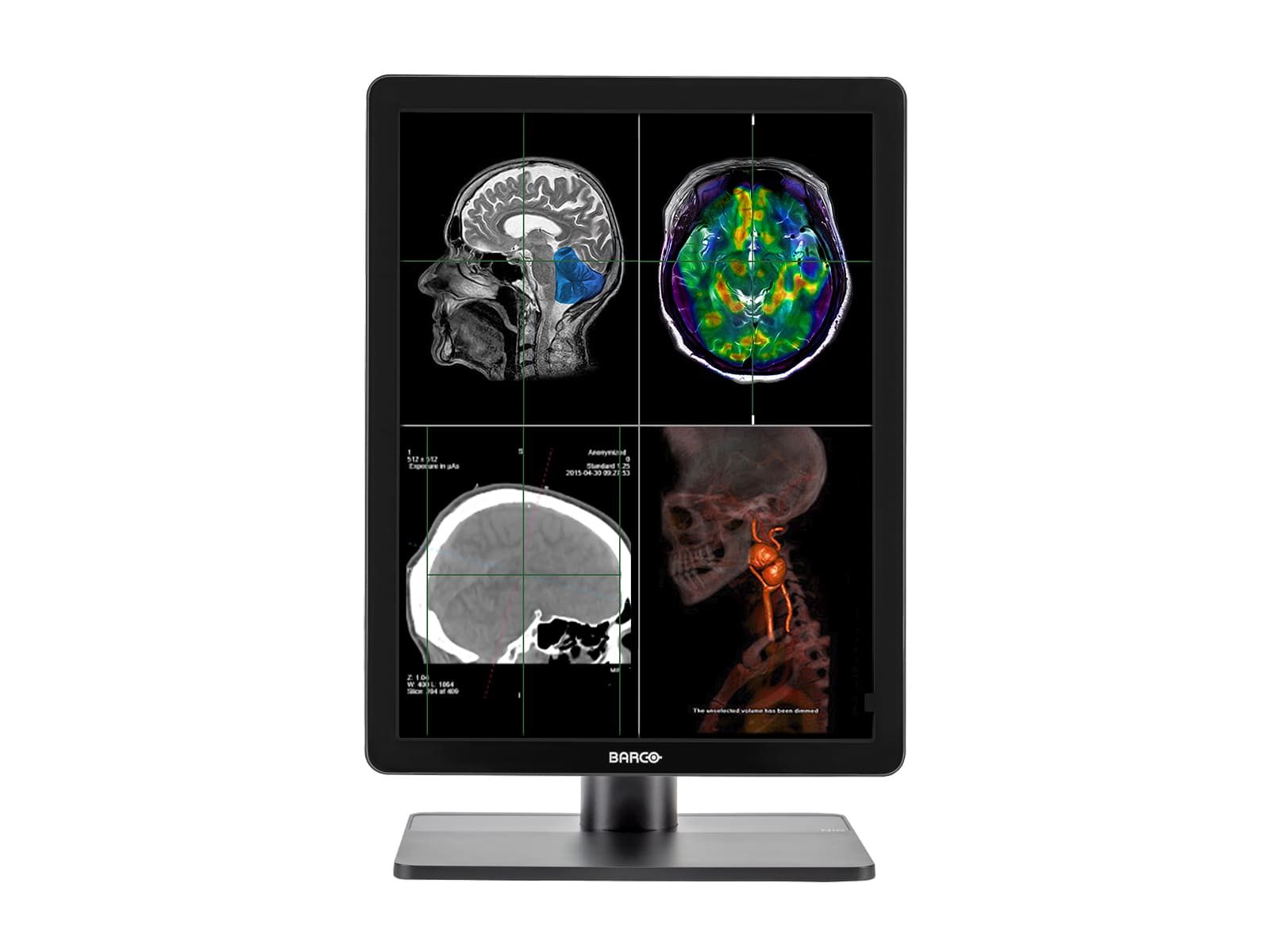 Barco Nio MDNC-2221 2MP 21" Color LED Diagnostic Radiology Display Monitor Monitors.com 