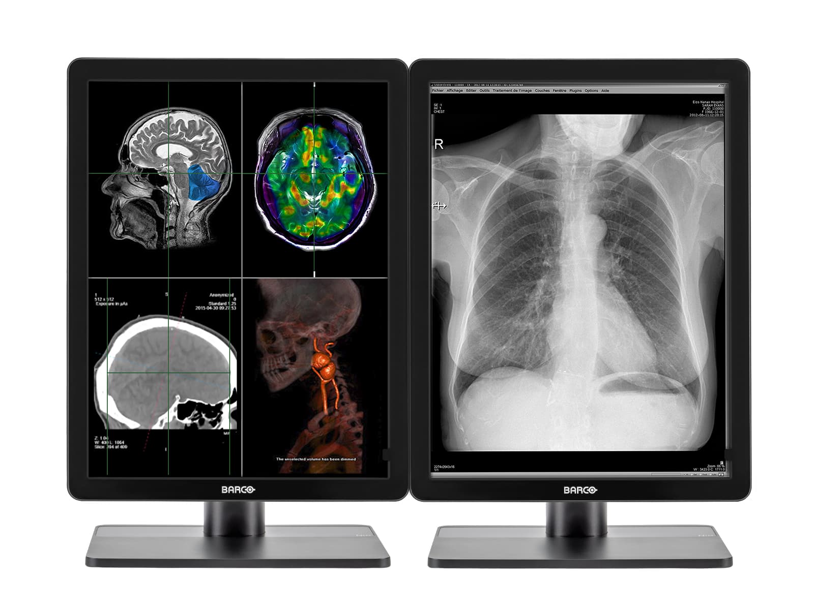 Complete PACS General Radiology Station | Barco 3MP Color LED Displays | Lenovo Workstation | Dictation Mic | Worklist Monitor (3321Z4R)