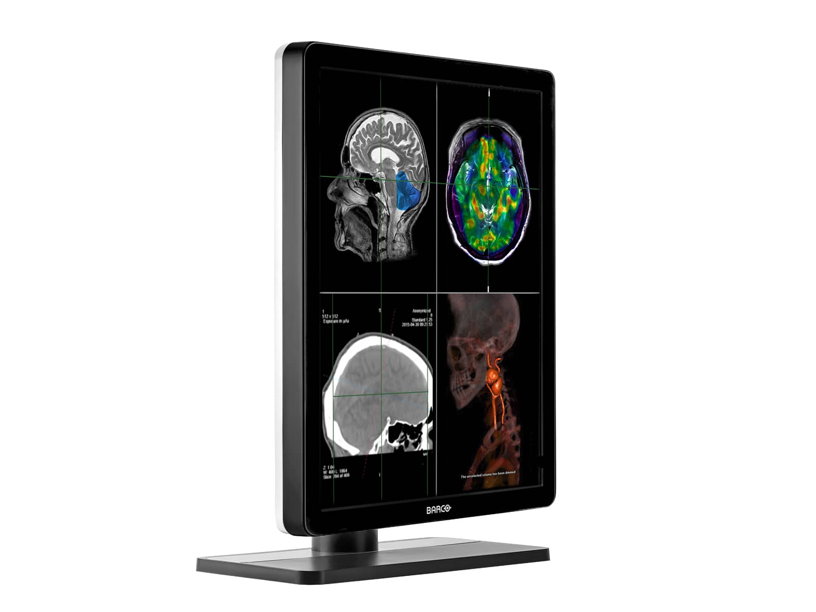 Barco Nio MDNC-3321 3MP 21" Color LED General Radiology Diagnostic PACS Display Monitors.com 