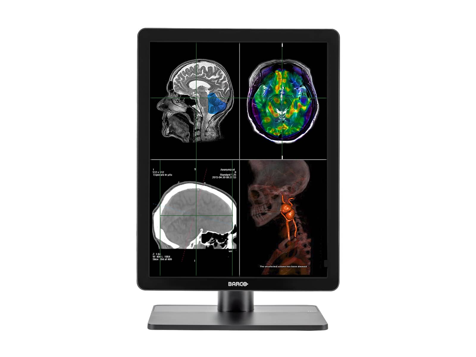 Barco Nio MDNC-3321 3MP 21" LED General Radiology Diagnostic PACS Display (K9300323A) Monitors.com 