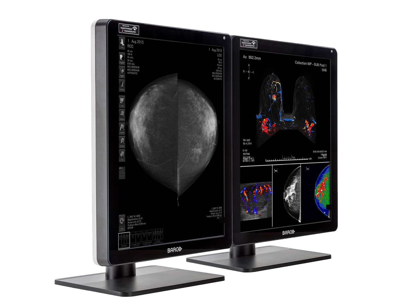 Barco Nio MDNC-6121 5MP 21" Color LED Mammo 3D-DBT Breast Imaging Display (K9300360A) Monitors.com 