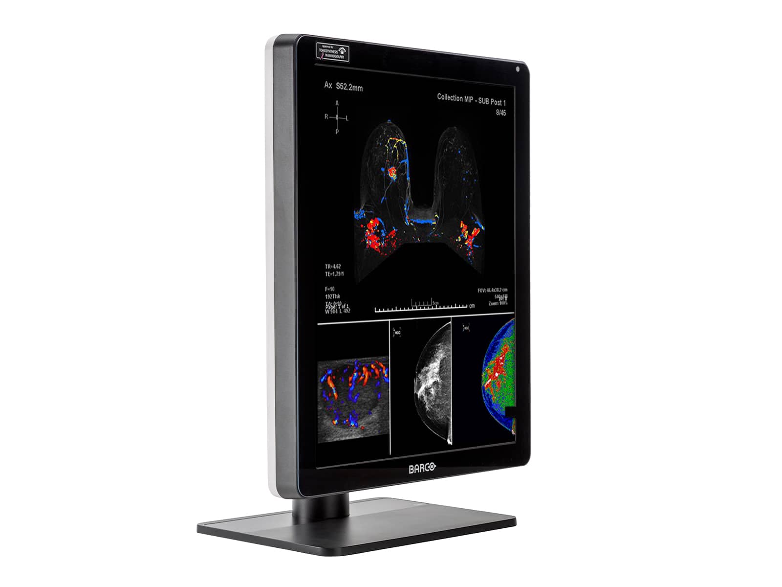 Barco Nio MDNC-6121 5MP 21" Color LED Mammo 3D-DBT Breast Imaging Display (K9300360A) Monitors.com 