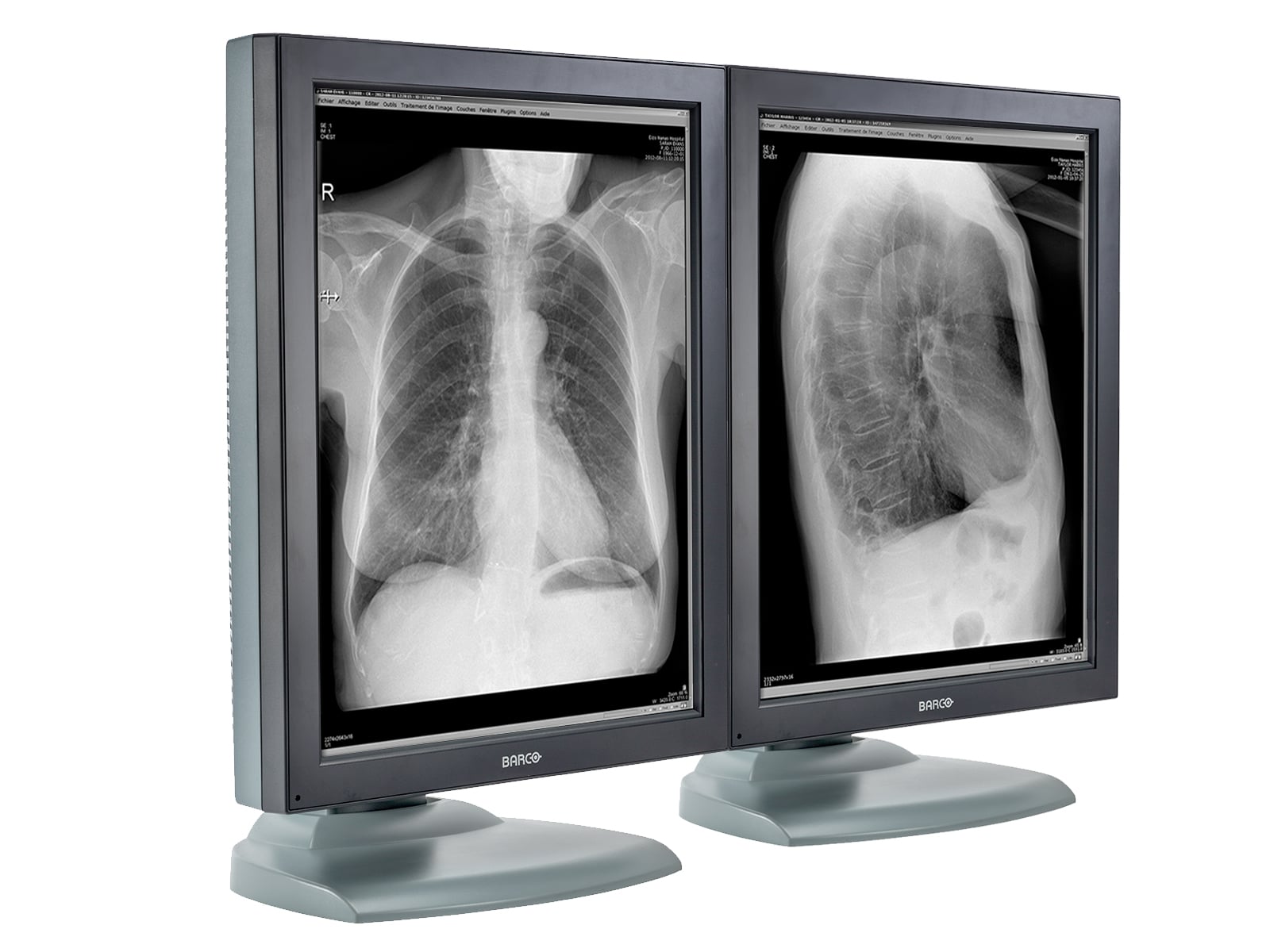 Barco Nio MDNG-2121 2MP 21" Grayscale Medical Diagnostic Radiology Monitor (K9601651) Monitors.com 